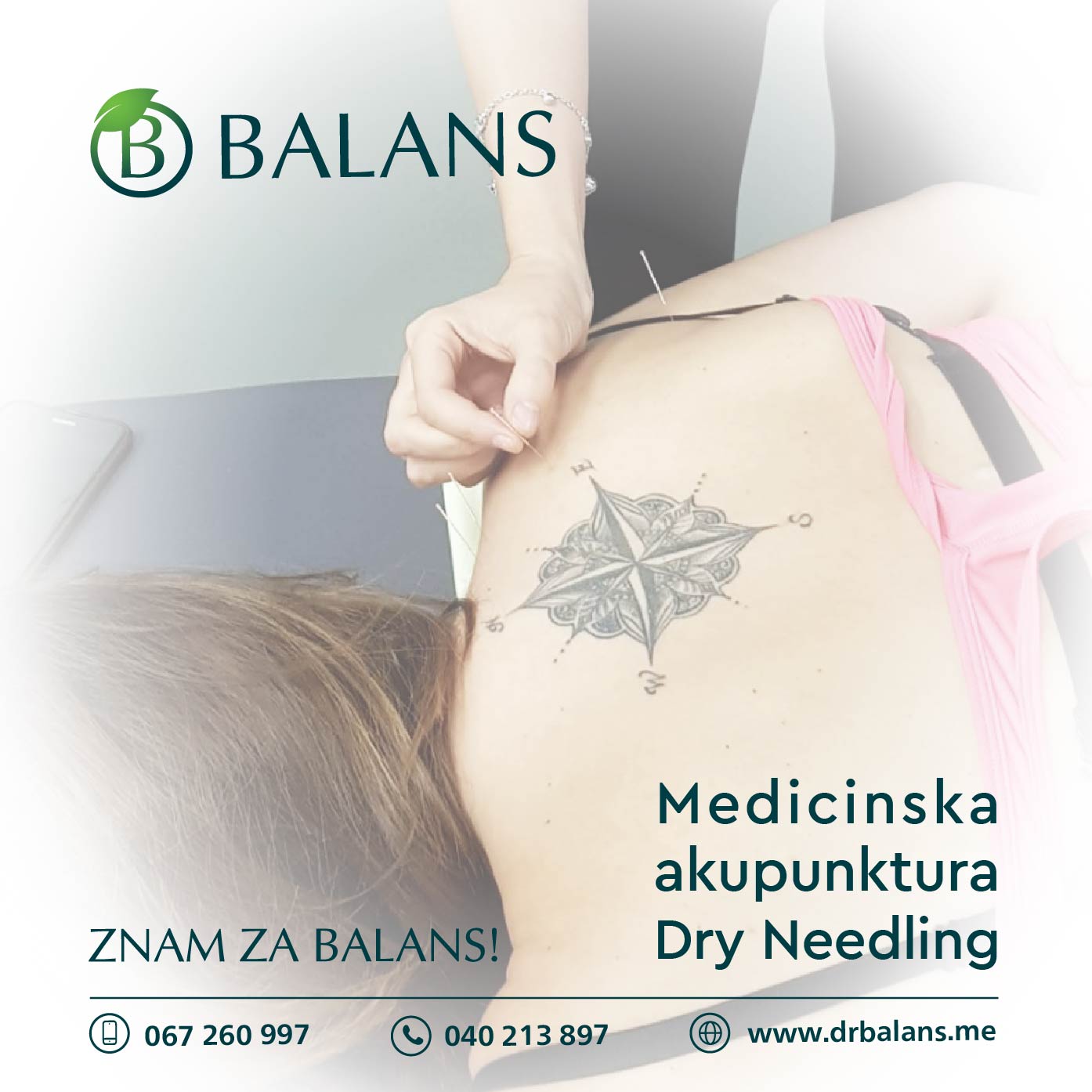 medicinska akupunktura